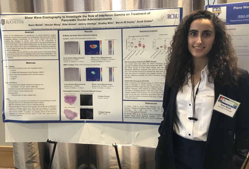 Research Rochester: Mislati uses ultrasound to research cancer