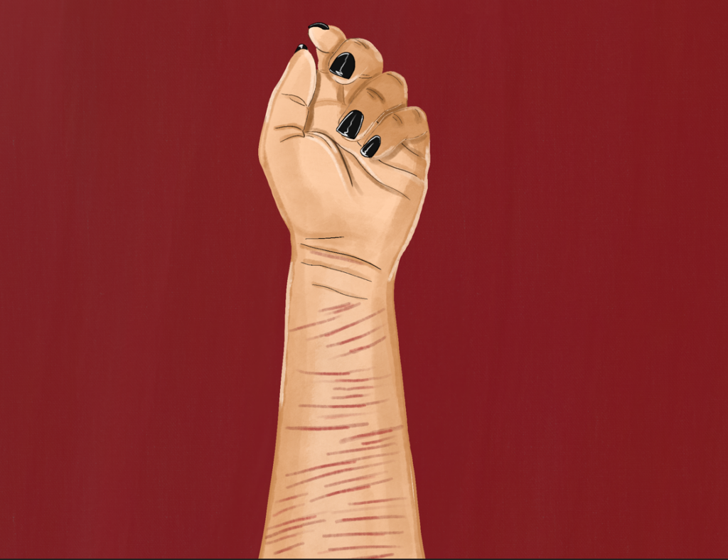 Scars, romance, and the minds of youth